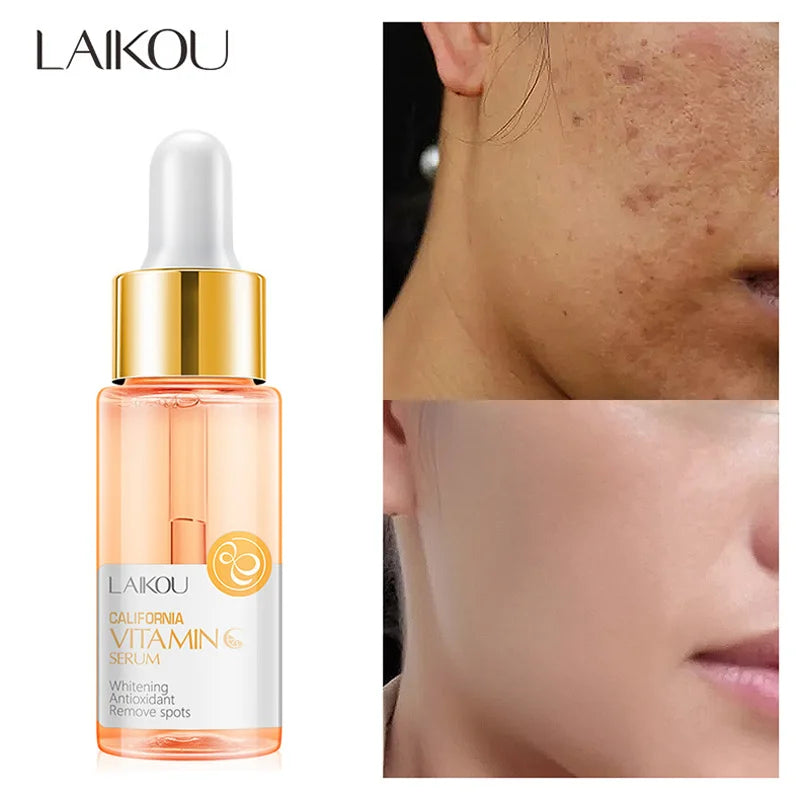 LAIKOU 24K Gold & Vitamin C Serum – Deep Moisture & Glow (17ml)